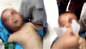 出門玩耍遇血災！1歲童慘遭5狗圍攻「撕咬臉部」...衣褲全爛爸心碎(圖/梨視頻)