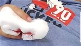 澎湖鳥嶼,混種犬,咬中指,女童(翻攝自澎湖資訊網)