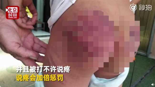一人不乖罰全班！男童被抽百鞭屁全爛