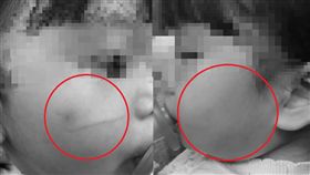 彰化２歲童疑遭托嬰中心虐待／翻攝自靠北惡質幼兒園臉書