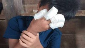 鞭炮炸碎4指男童自己包紮好　母打開看差點暈倒(圖/中國報)