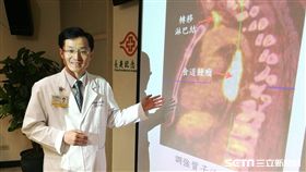 醫師洪宗民說明食道癌成因。（圖／記者楊晴雯攝）
