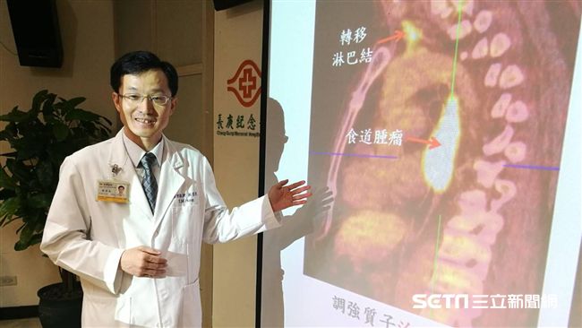 男子拿「它」當水喝　竟喝出食道癌