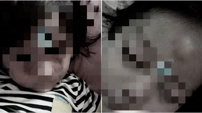 又虐童！女童打成熊貓眼　幸尋獲安置