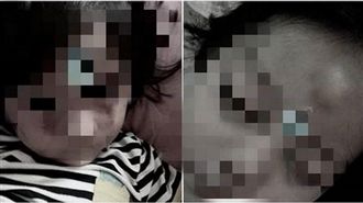 又虐童！女童打成熊貓眼　幸尋獲安置