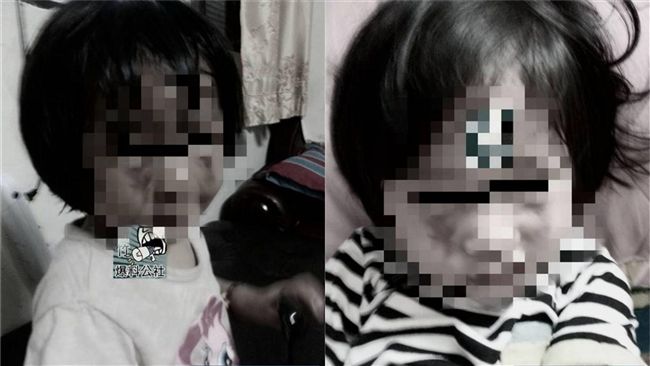 2歲女遭繼父家暴！母竟帶她求復合