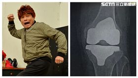 許效舜左膝x光
圖／許效舜提供