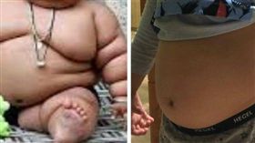 胖小孩, 兒童肥胖, 青少年肥胖