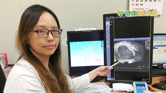 她反覆下腹疼痛　竟因子宮內膜異位症