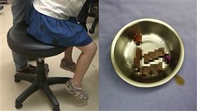 流出咖啡色分泌物…8歲女童下體飄惡臭　醫檢查挖出5玩具（圖／資料照、翻攝自廣州日報﹚