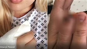 女睡醒拇指消失　竟是被夢遊男友吃了 （圖／翻攝自BHAZ）