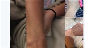 一名國外女網友近日在社群網站貼文說，大家手腕中間都有雀斑，結果竟引起逾萬網友回覆表示認同，並秀出照片證明。（圖／翻攝自Twitter／aarynwhitley）