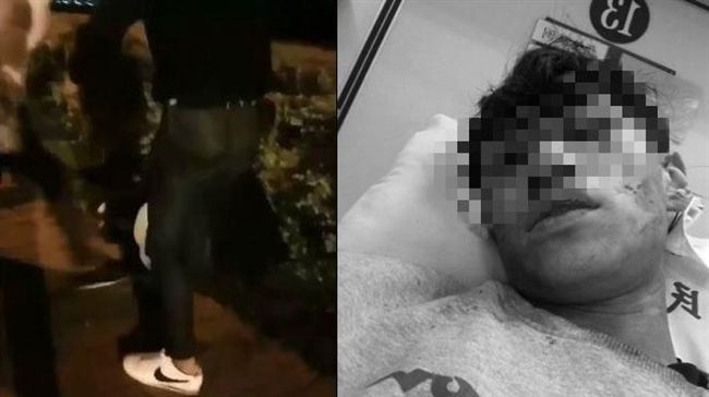 少年看夜景慘遭40人圍毆？真相是…