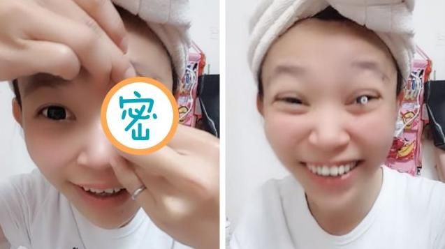 太恐怖！用吸棒拔隱眼「眼球險掉出」