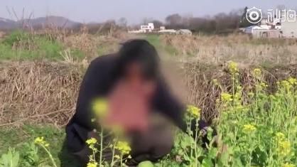 怪物！52歲男臉頂「籃球大腫瘤」