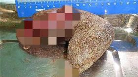 俄羅斯托木斯克市一名16歲少女，她的肚子腫脹如「孕婦」，沒想到就醫檢查後，醫生發現她的胃被不明物體塞滿，原來女子患有「食毛癖」，經常拔自己的頭髮吃下去。後來醫師透過手術，成功將重達「5公斤的頭髮」取出，而女子術後恢復狀況良好，但仍須接受精神方面的治療。（圖／翻攝自杭州網）