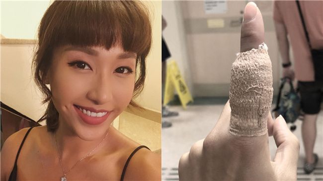 洗廁所洗出事！女星食指整塊肉被削掉