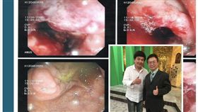 賀一航  大腸癌 蕭敦仁 直腸外科 腸道