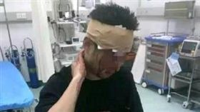 大陸知名網紅錢小佳遭粉絲砸酒瓶爆頭。(圖/翻攝自騰訊)