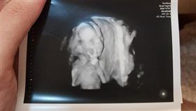 超音波照兒神比YA　爸曝曾胎夢2次（圖／翻攝自爆廢公社公開版臉書）