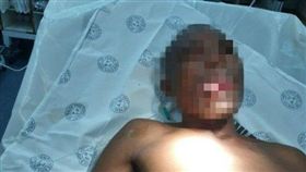 南非,男子強吻女醫師舌頭遭咬斷（圖／翻攝自推特）