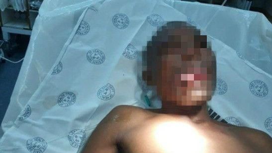 色狼扮病人「硬插」　女醫師一口咬斷