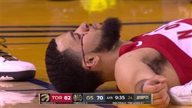 Fred VanVleet眼角血流如注。（圖／翻攝自Youtube）