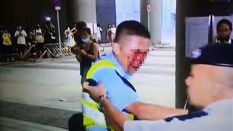 港反送中深夜爆衝突　警「滿臉鮮血」