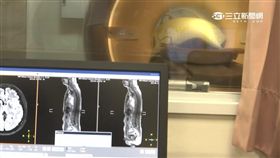 死亡時鐘調快20秒 驚!每年8千人死於肺癌