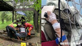 台中青桐林生態園區木棧道崩塌、患者受訪／翻攝畫面、記者張展誌攝