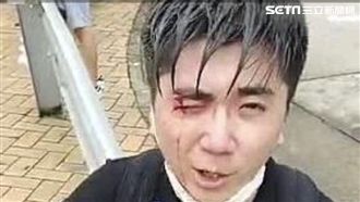 警察開槍擊佔中港民　右眼鮮血直流