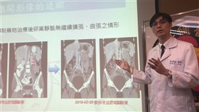 女童性早熟腹痛難耐　竟罹患熟女病三軍總醫院小兒內分泌及新陳代謝科主任醫師林建銘（圖）表示，一名女童6歲時確診性早熟，到了10歲腹痛愈來愈嚴重，後來確診罹患熟女病「骨盆腔鬱血症候群」，是全球首次發現同時被診斷性早熟及骨盆腔鬱血症候群的個案。中央社記者張茗喧攝　108年6月12日