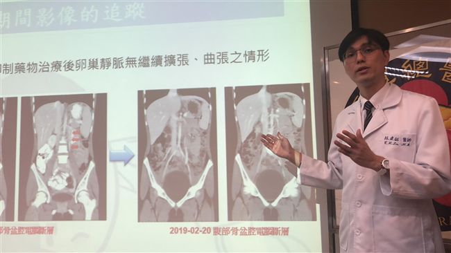 女童性早熟腹痛難耐…竟罹患熟女病