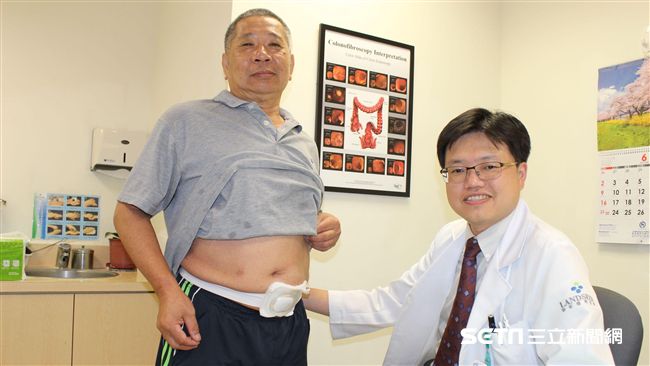 超熱血！為救腸癌人　他竟「狂露肚」
