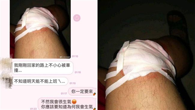 工讀「被車撞」請假！照片放大全露陷