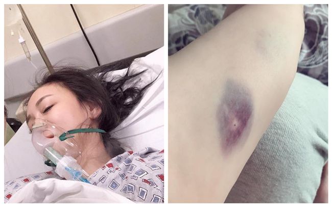 赴美送急診！太陽花女王病床憔悴照曝