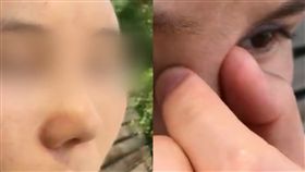 整型,鼻樑,三角眼,大陸　圖／翻攝自梨視頻