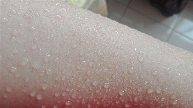 全台高溫！女秀恐怖「密集汗珠」