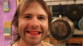 生肉,腐肉,過敏,飲食,奶昔,益生菌,素食,味覺,食慾,美國,　圖／翻攝自推特　