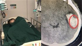 KTV,唱歌,腦出血,血壓,鄭州,考試,緊繃,放鬆,頭暈,噁心,嘔吐,　圖／翻攝自微博