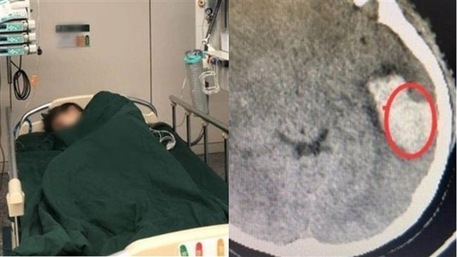 女大生KTV高歌嗨唱　意外爆腦血管