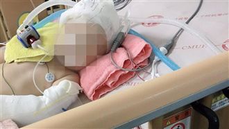 1歲女嬰疑遭虐昏迷插管　保母是新手