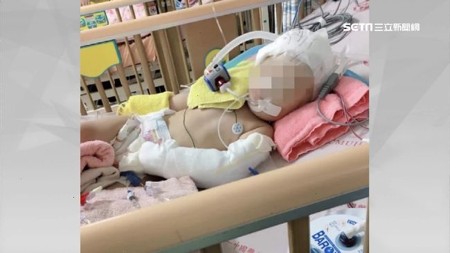 1歲女嬰遭虐癱！母淚：保母判刑太輕