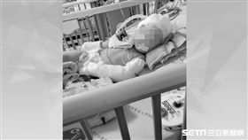 台中1歲女童疑遭保母虐待