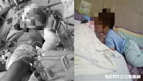 台中1歲女童疑遭保母虐待、保母虐童案／陳媽媽授權提供