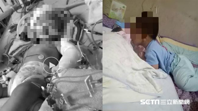 童遭虐命危…母淚求：拜託給我個奇蹟