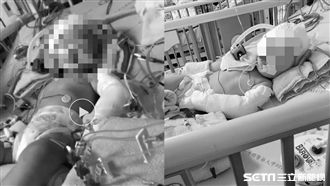 保母涉虐女童害命危　確定遭收押禁見