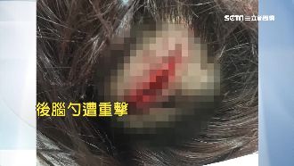 「我沒性騷女學生！」師遭家長打破頭