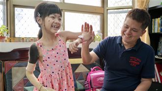 全身黑痣也不領身障手冊　琪爸曝原因