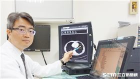 新竹馬偕胸腔外科主任陳百璽